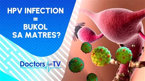 ano ang puke|Bukol Sa Pepe O Vaginal Cysts: Types At Treatment .